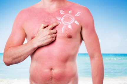 Toronto skin cancer, Toronto wrinkles, Toronto sunscreen, Toronto skin care, Toronto best sunscreen